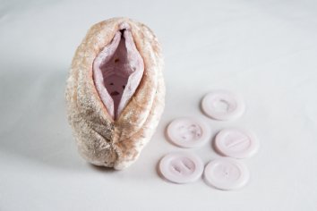 Jungfernhäutchen (Hymen)